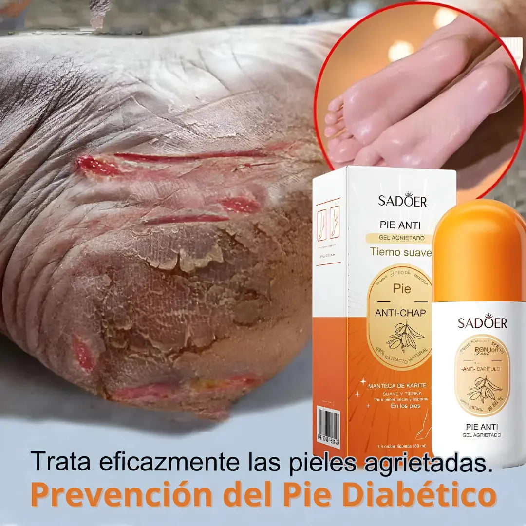 Gel Reparador "pies secos y agrietados"